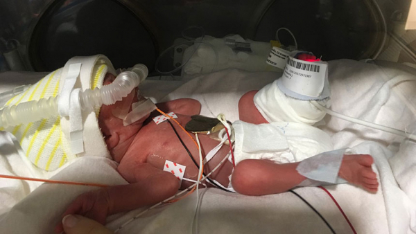 Moms' group supports family with infant in NICU